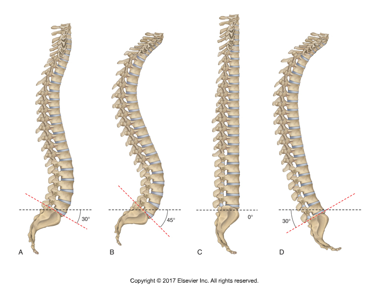 Spinal Postures. Permission: Dr. Joe Muscolino.